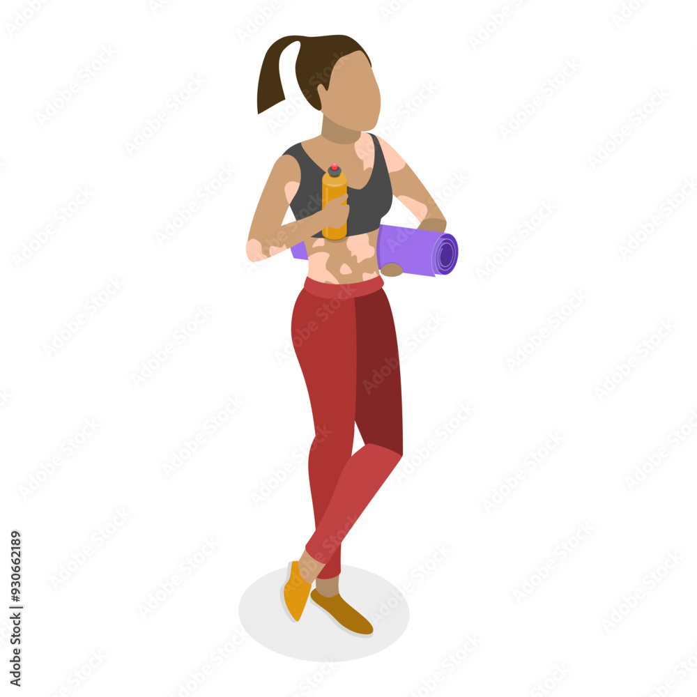 3D Isometric Flat Vector Set of Happy People with Vitiligo, Light Spots on the Skin. Item 3 3D Isometric Flat Vector Set of Happy People with Vitiligo, Light Spots on the Skin. Item 3