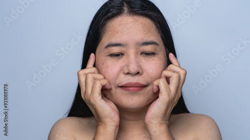 Woman with facial skin problems of freckles, dark spots, and wrinkles on the face Enlarged pores on combination skin Expressing a tense, thoughtful expression Dull and rough skin  Healthy concept.