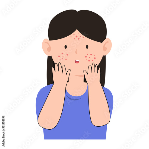 acne facial skin proplem. anti acne skin care concept