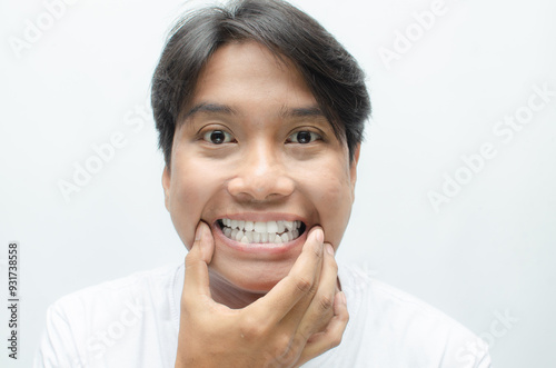 young asian man smiling and showing his crooked teeth isolated over white background. dracula teeth and bucktooth concept. overlapping teeth of man