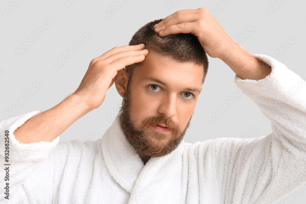 Handsome young man with hair loss problem on white background