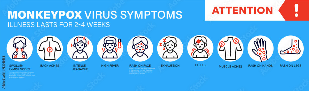 Monkeypox virus Symptoms. New cases of Monkeypox virus are reported in ...