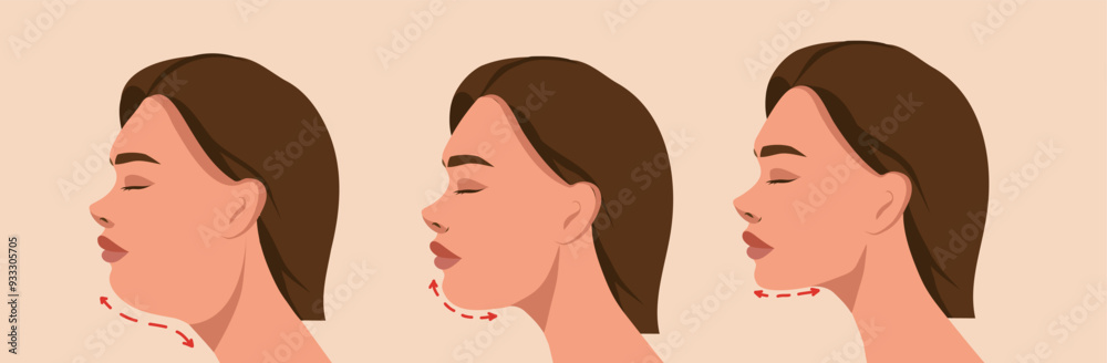 Massage and taping. Woman before and after. A woman with a double chin. SMAS lifting. Expression wrinkles. Vector template for advertising, website, banner, posters, cover Massage and taping. Woman before and after. A woman with a double chin. SMAS lifting. Expression wrinkles. Vector template for advertising, website, banner, posters, cover
