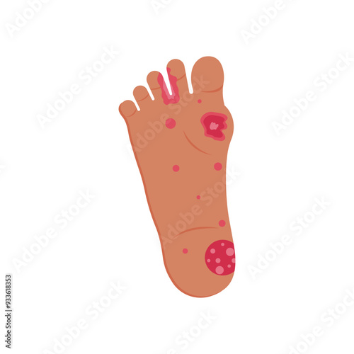 Skin rash, insect bites allergy reaction. irritation on foot logo vector illustration