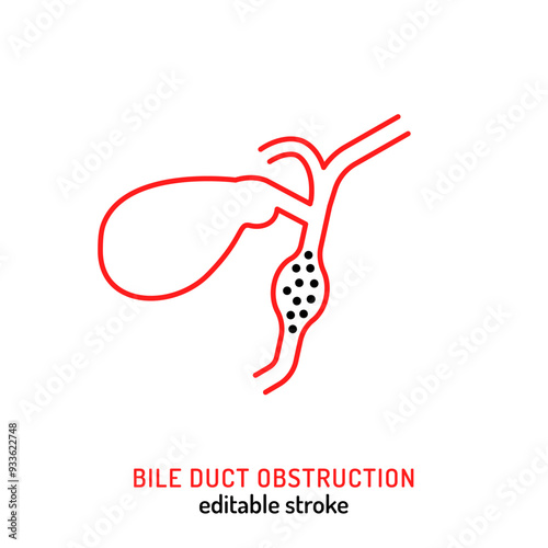 Bile duct obstruction icon in outline style.