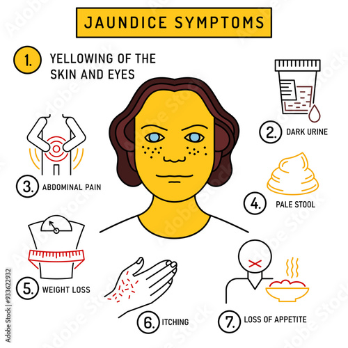 Jaundice symptoms infographic in outline style. Vector illustration isolated on a white background
