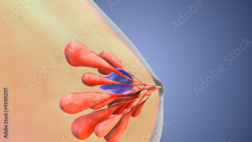 Cuadro en lienzo Medical animation for the treatment of breast cancer nodule