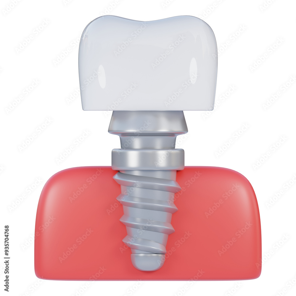 dental implant 3d icon illustration dental implant 3d icon illustration