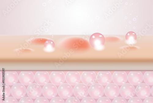 illustration of serum removing acne on the skin layer
