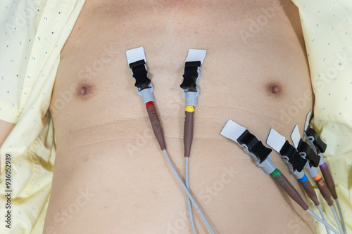 Closeup of a man chest with electrodes for measuring electrocardiography