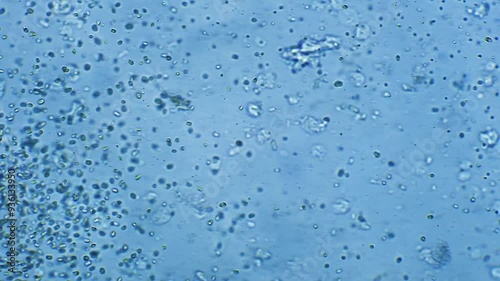 Colony of bacteria floating in water