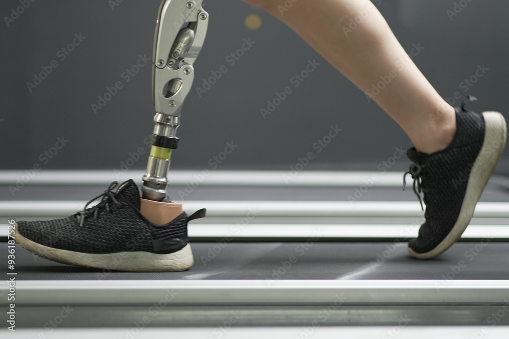 custom made wallpaper toronto digitalprosthetic, artificial leg. Woman with prosthetic leg using walking on treadmill while working out in gym. artificial leg. Woman wearing prosthetic equipment sit down after exercising in gym.