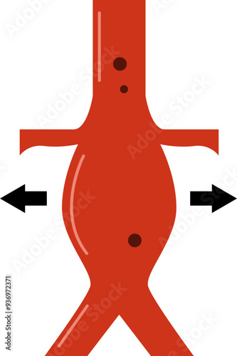 Ruptured Aortic Aneurysm