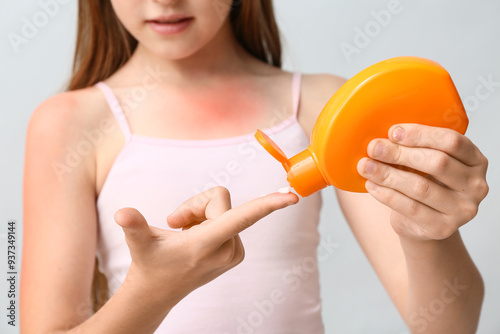 Little girl with red sunbur...