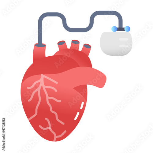 A flat icon of heart pacemaker implant 
