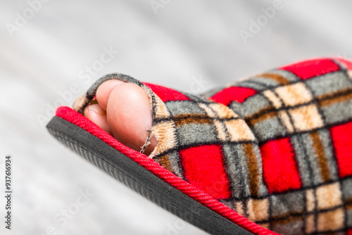 foot shod in an old leaky slipper. old slipper. holey sneaker. the toe sticks out of the shoe in the slipper