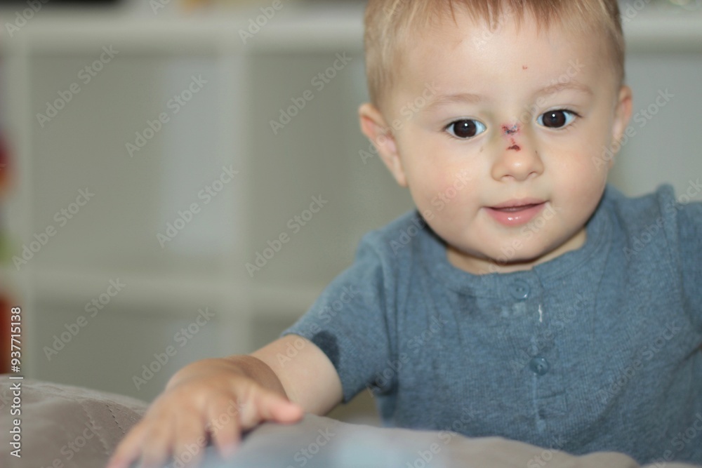 A small child with a wound on his nose tries to explain something A small child with a wound on his nose tries to explain something