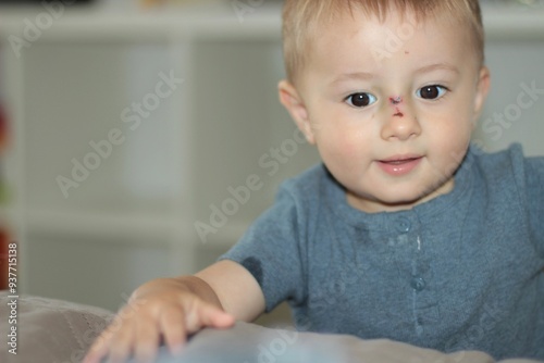 A small child with a wound on his nose tries to explain something