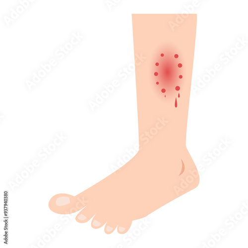 cat, dog to bite lick and scratch. rabies vaccine prevention