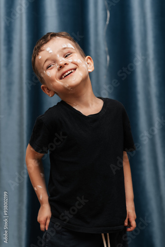 Portrait of a Caucasian boy with chickenpox.