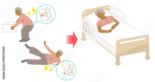 Elderly black woman confined to bed with fractures of femur and spine due to osteoporosis