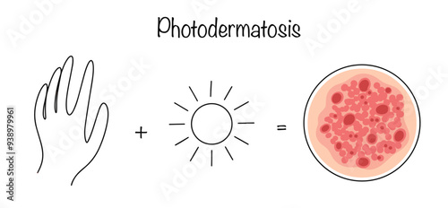 Photodermatosis