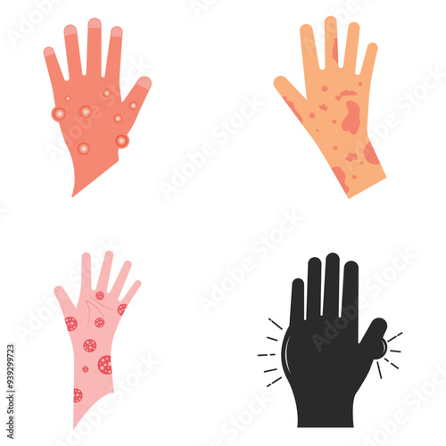 Skin rash, insect bites allergy reaction. irritation on hand logo vector illustration