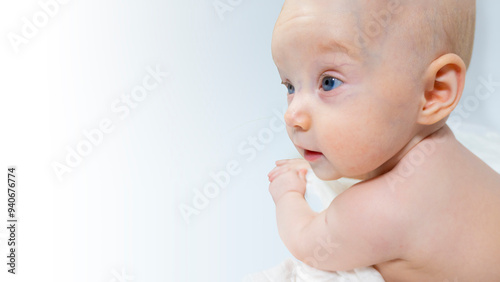 Obraz na płótnie a baby with a hemangioma on his neck lies on a white background. banner with a copy space. profile of a little bald baby girl. the kid looks to the side w salonie