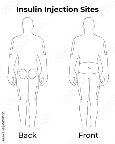 Insulin Injection Sites Science Design Vector Illustration Diagram