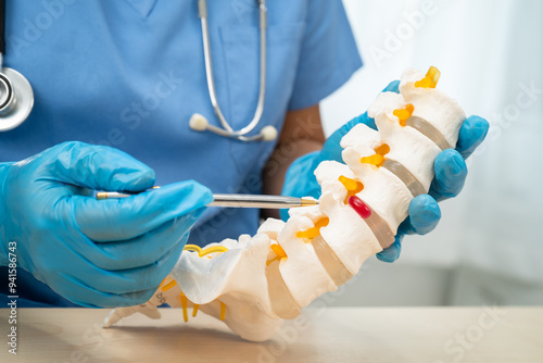 Doctor holding lumbar vertebrae spine skeleton bone and spinal nerve with displaced herniated disc fragment for treatment medical in the orthopedic department. photo