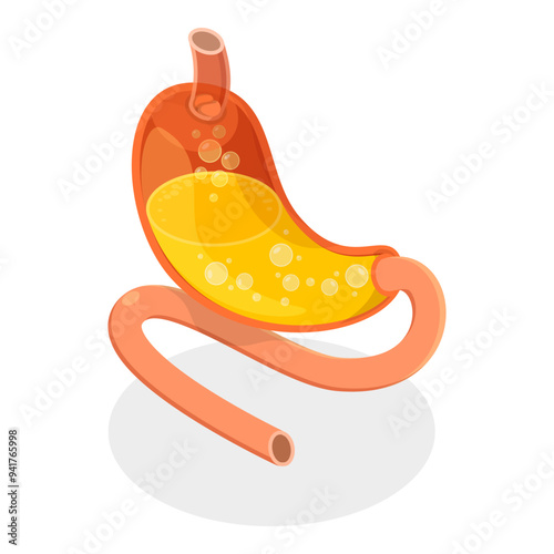 3D Isometric Flat Vector Set of Stomach Problems, Digestive System Issues. Item 3
