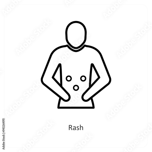 Rash