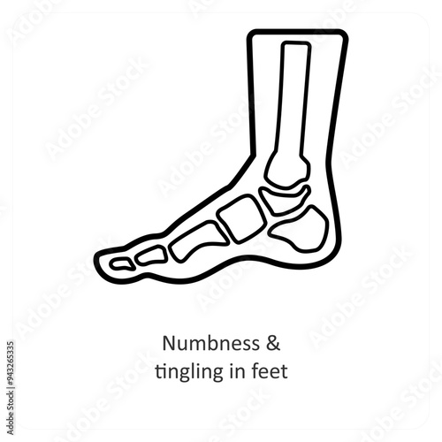 Numbness & Tingling In Feet