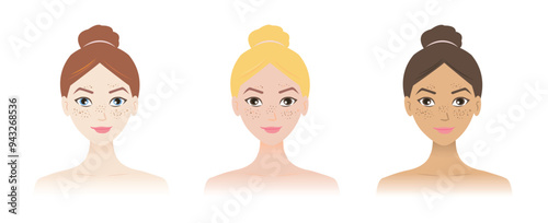 The women with freckles on different skin tone vector illustration isolated on white background. Ephelides can occur in anyone light skin and have blond or red hair, but anyone can have freckles.