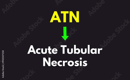 ATN Meaning, Acute Tubular Necrosis photo