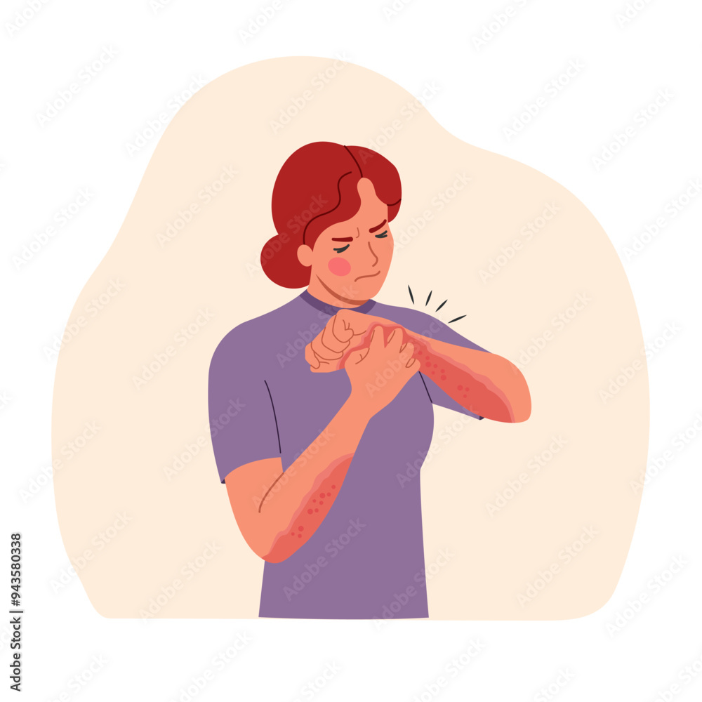 Young suffering woman scratching the skin on her hand isolated. Allergy concept. Vector flat style cartoon illustration Young suffering woman scratching the skin on her hand isolated. Allergy concept. Vector flat style cartoon illustration