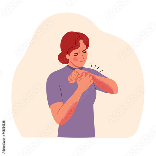 Young suffering woman scratching the skin on her hand isolated. Allergy concept. Vector flat style cartoon illustration