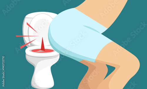 Hemorrhoids, medical concept, the problem of going to the toilet.