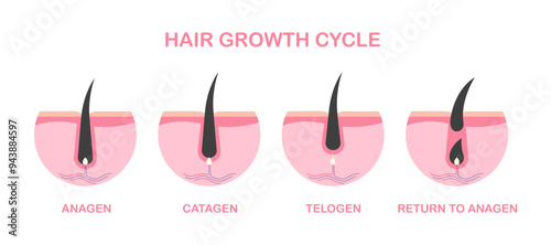 Hair growth cycle of follicles phase diagram hair roots structure. Hair grows stages: Anagen - growing phase, Catagen - transition phase, Telogen - resting phase.