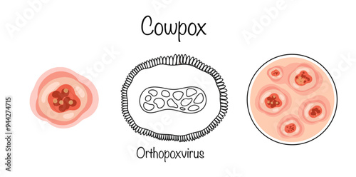 Cowpox