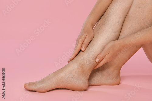 Woman suffering from varicose veins on pink background, closeup