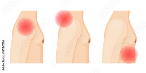 Man with Shoulder, Neck and Ribs Pain
