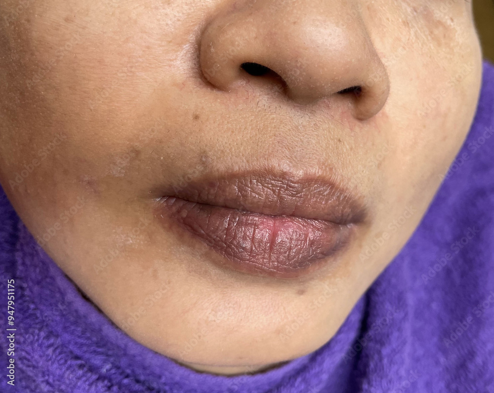 Fototapeta premium Before lip tattoo