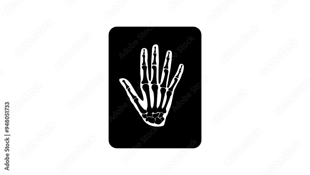 x-ray of hand, black isolated silhouette x-ray of hand, black isolated silhouette
