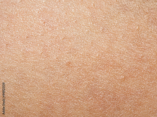 Close-up of skin showing texture and structure, highlighting details important to the study of dermatology