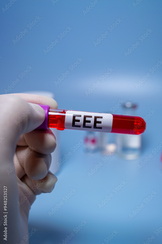 Obraz premium Eastern Equine Encephalitis (EEE) is an extremely rare but serious and often fatal infection that causes encephalitis or inflammation of the brain