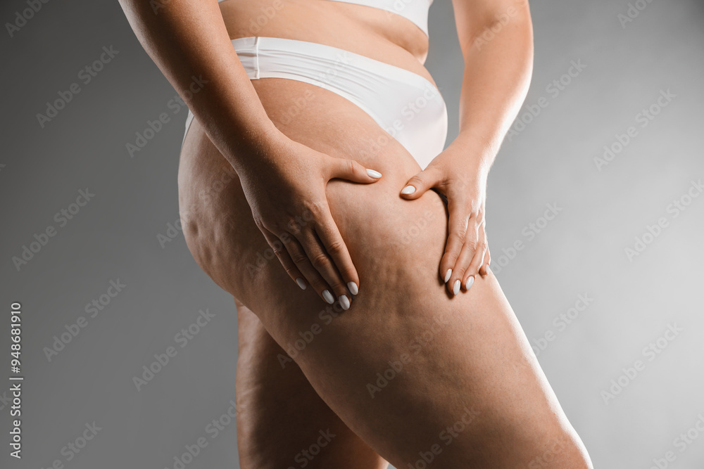 Woman with cellulite on grey background, closeup Woman with cellulite on grey background, closeup