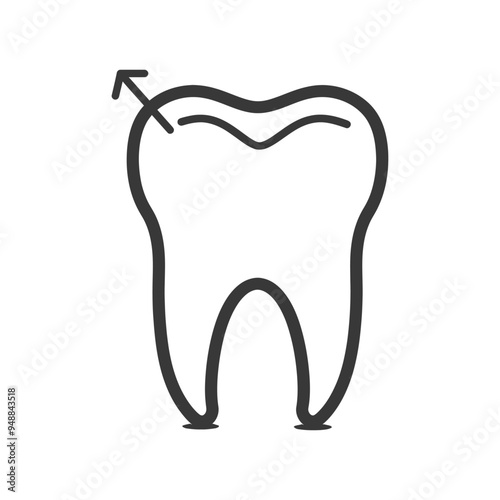 Tooth with Arrow Indicating Enamel Erosion