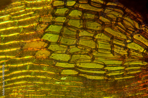 Alar cells of a branch leaf from a broom moss.