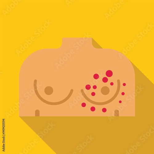 Female chest with red spots illustrating the symptoms of chickenpox